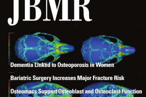 Images from our recent publication on the cover page of Journal of Bone and Mineral Research